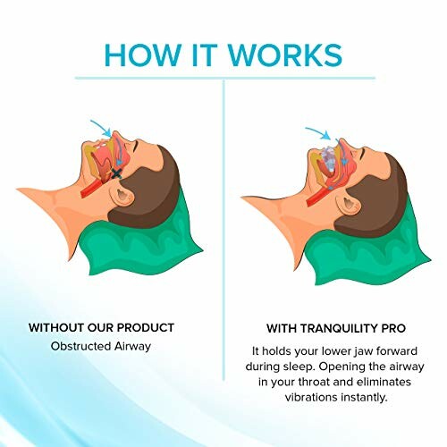 Illustration comparing obstructed airway without product and open airway with Tranquility Pro